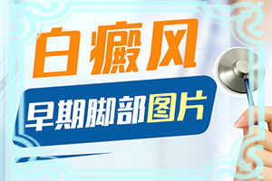 头上有白斑是怎么回事