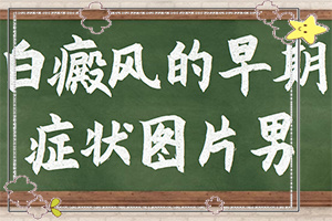 手被油烧伤后留下的白斑怎么治,患发是什么原因(原因有哪些)