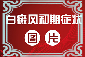 上嘴皮有白斑是咋回事-得白癜风的概率