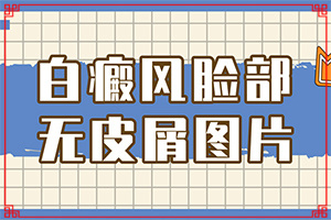 白癜风病因-八岁小女孩腿上突然有决小白块怎么回事