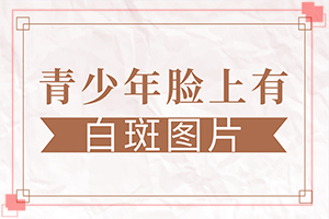 儿童胳膊白斑是什么原因引起的,发病的原因有哪些(什么原因会诱导白斑)