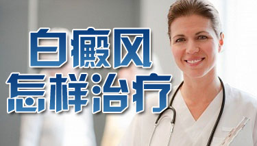 怎么治疗白癜风好