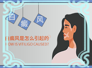 [如何控制]白癫疯怎么治疗好