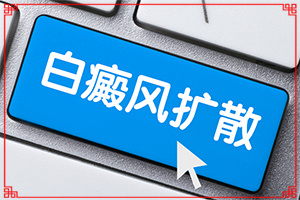 [怎样治疗白癜风患者]阴道白班怎么治