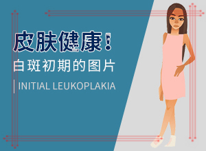 [会怎么样]阴道白班怎么治