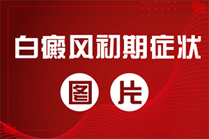 [什么时候可以好]治疗儿童白斑需要多少钱