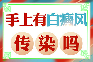 好的白癜风医院是哪个(能尽快治疗好吗)
