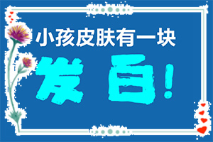 白巅峰治疗最新疗法(怎么治疗安全)