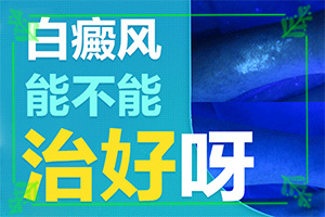 [严重还能治好吗白颠疯怎么治