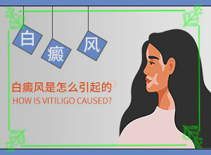 [如何正确治疗白斑]手上一年多白斑怎么治呢