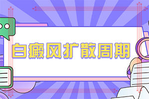 [这有几种好方法]指端白癫风怎么治疗更好