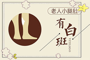 儿童白癞癜风能治好吗(诊治的方法有哪些)