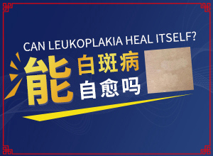 [治疗后可以恢复吗小孩子白点癫风能治疗好吗