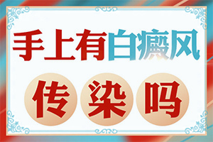 [治疗后可以恢复吗小孩子白点癫风能治疗好吗
