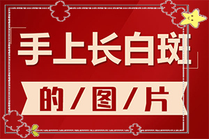 治疗白癫疯大约多少钱(如何治疗效果好)