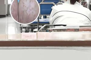 贵州白癜风皮肤病医院是正规医院吗多少钱