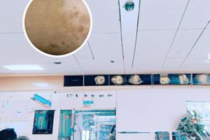 贵州白癜风皮肤病医院白斑收费贵吗