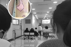 白癜风从中医的角度是什么原因