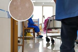 复方甘草酸苷片治白癜风