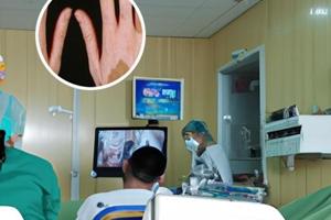 复方卡力孜然盯