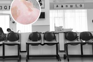 贵州白癜风白斑医院消费高吗多少钱