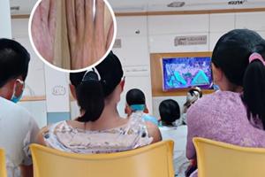 白斑吃复方甘草酸苷片可控制住吗