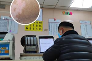 白点癫风是否会影响肾功能