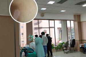 伍德灯灰白色是什么