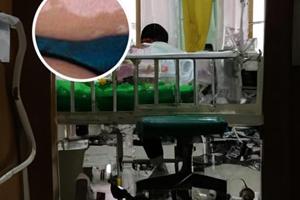 贵州白癜风皮肤病研究所专家部在哪里