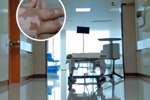 311光疗使用说明