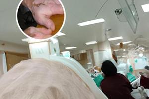 家用308白癜风光疗仪哪种好