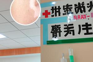 中药熏蒸的作用和功效是什么