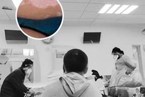 色素脱失症是什么病,能治好吗图片