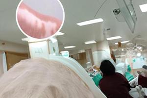 308激光治疗会照伤皮肤吗图片对比