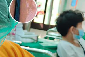 贵州皮肤病医院是正规医院吗知乎