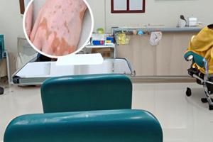 安顺皮肤科最厉害的三个医院