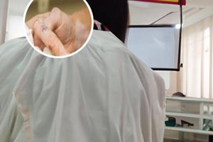 小孩脚上长白斑是怎么回事
