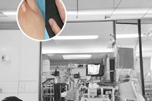 他克莫司怎么用才能效果好