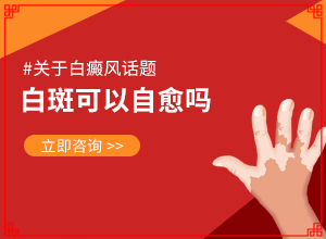 做些什么检查是否是白癜风(会是什么样的呢)