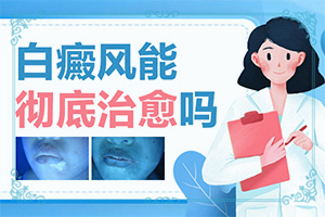 白斑症状和图片-仁怀市白癜风报销