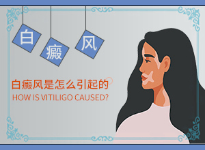 皮肤上出现白块-白癜风如何检查出来