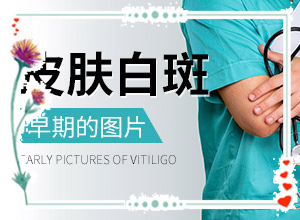 白斑有什么症状图片-皮肤上出现白色斑点