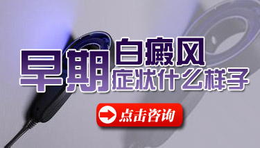 白癜风初期有什么症状