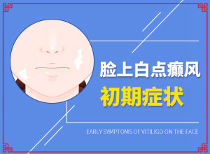 儿童早期白斑图片-怎么诊断自己得了白癜风