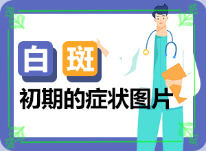 女人脸上长白斑图-白颠病初期症状