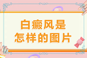 白癫风的症状,症状比对(身体上有一小部分)