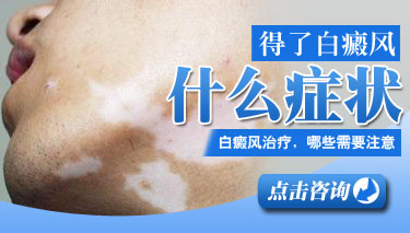 白癜风的症状是什么样的