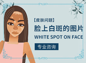 白班病的初期图片,怎么回事白斑(发生时有什么症状)