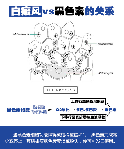 白斑