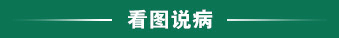 看图说病